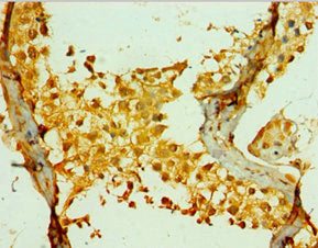 PIKFYVE Antibody