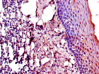 TACC3 Antibody