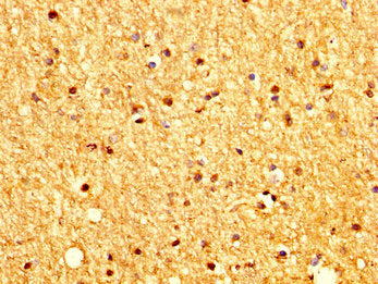 PTCH2 Antibody