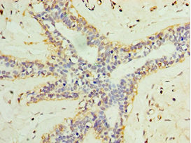 L3MBTL1 Antibody