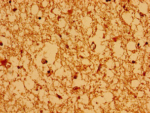 AXIN2 Antibody