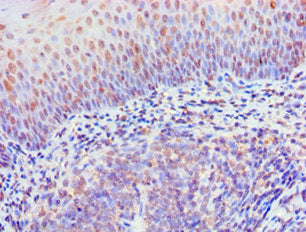 RIPK3 Antibody