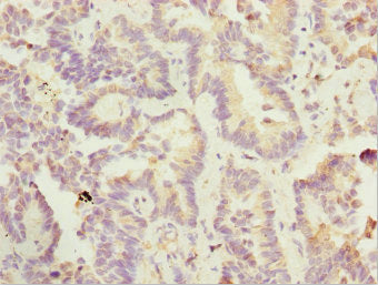 SIK3 Antibody