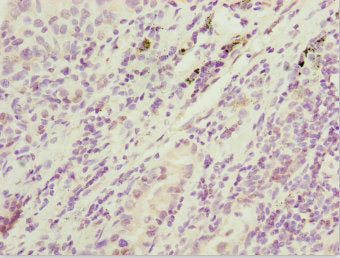 SIK3 Antibody