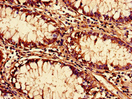 SF3B6 Antibody