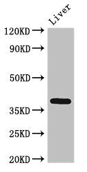ETV7 Antibody
