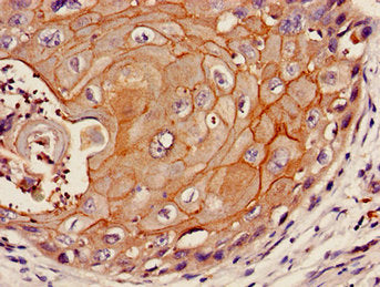 F11R Antibody
