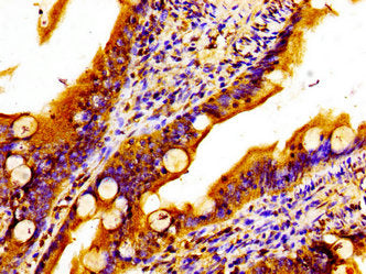 MTCH2 Antibody
