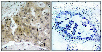 Phospho-KDR (Tyr1175) Antibody