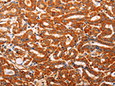 SLC25A4 Antibody