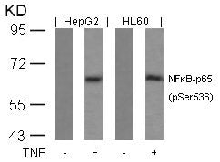 Phospho-RELA (Ser536) Antibody