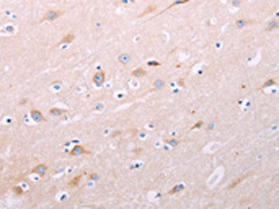 ADCY5 Antibody