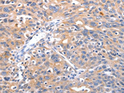 RCHY1 Antibody