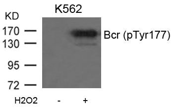 Phospho-BCR (Tyr177) Antibody