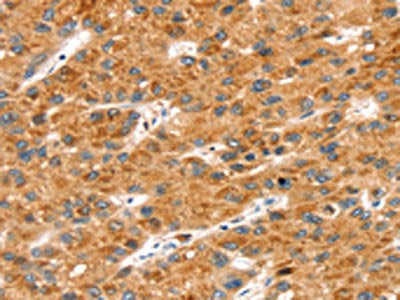 SOX11 Antibody