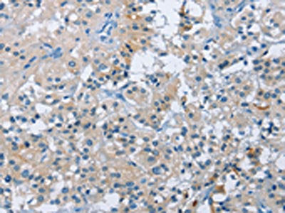 BTN2A2 Antibody