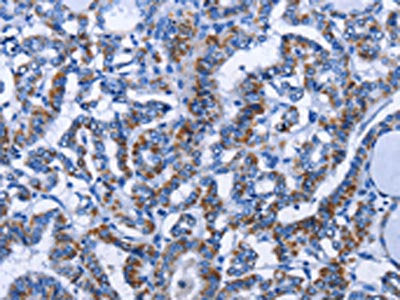 MMP16 Antibody