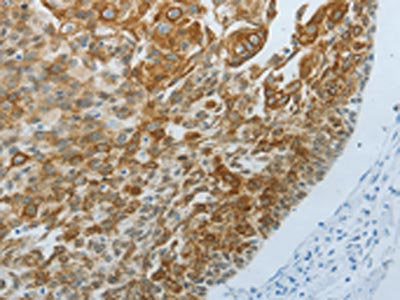TP63 Antibody