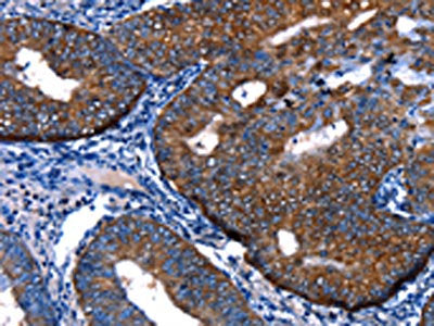 FOXJ1 Antibody