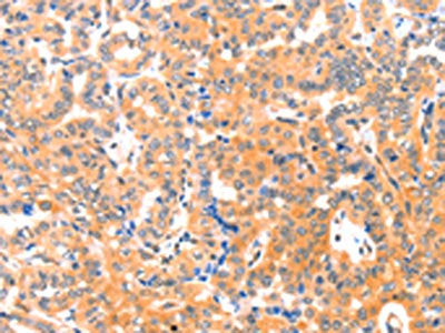 THBS1 Antibody