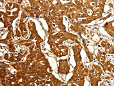 CDH23 Antibody