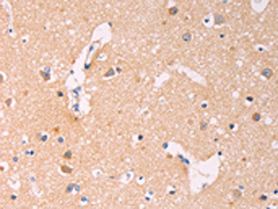ADCY1 Antibody