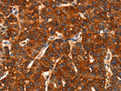 DHH Antibody