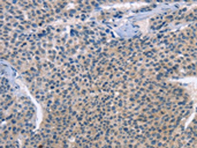 LRRK2 Antibody