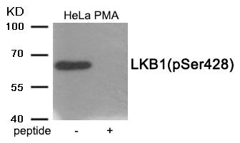 Phospho-STK11 (Ser428) Antibody