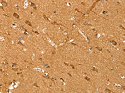SIRT4 Antibody