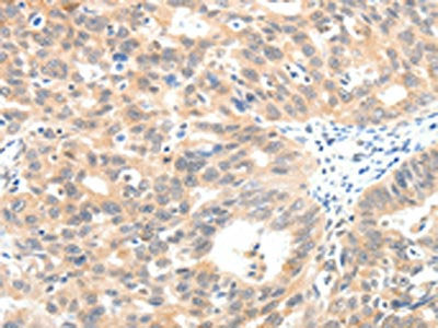 SCN2A Antibody