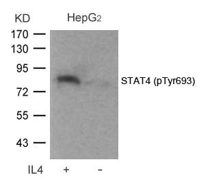 Phospho-STAT4 (Tyr693) Antibody