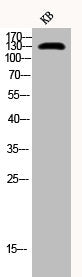 Phospho-INPP5D (Y1021) Antibody