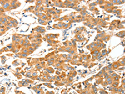 ADAMTS18 Antibody
