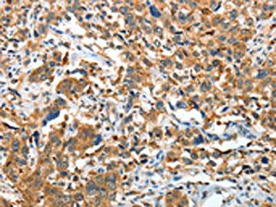 IL22RA1 Antibody