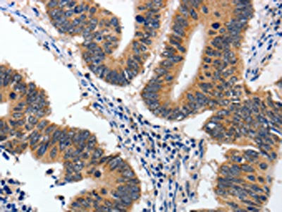 YWHAE Antibody