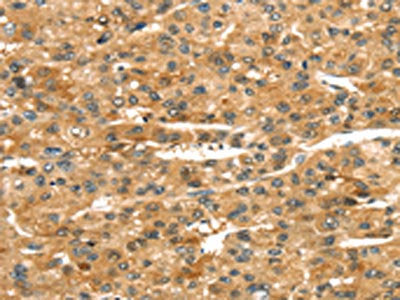 ROBO4 Antibody