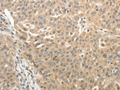 TH Antibody