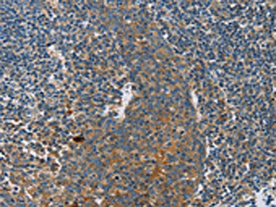 INHBA Antibody