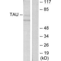 MAPT (Ab-396) Antibody