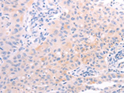 AMH Antibody