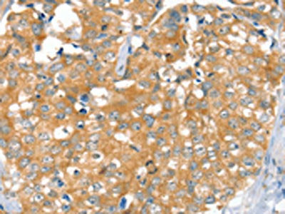 SLC9A9 Antibody