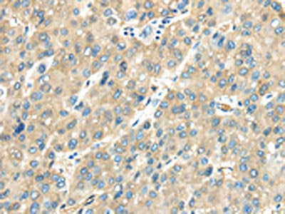 VPS4A Antibody