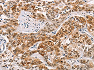 CABLES1 Antibody