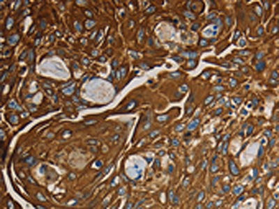 NRP1 Antibody