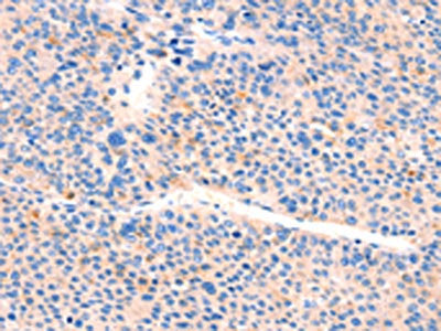 AIMP2 Antibody