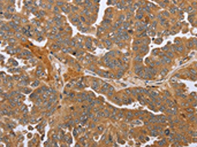 NMT1 Antibody