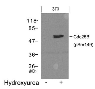 Phospho-Cdc25b (Ser149) Antibody