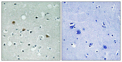 Phospho-LATS1/LATS2 (Thr1079/1041) Antibody