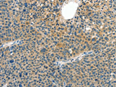 CRLF2 Antibody